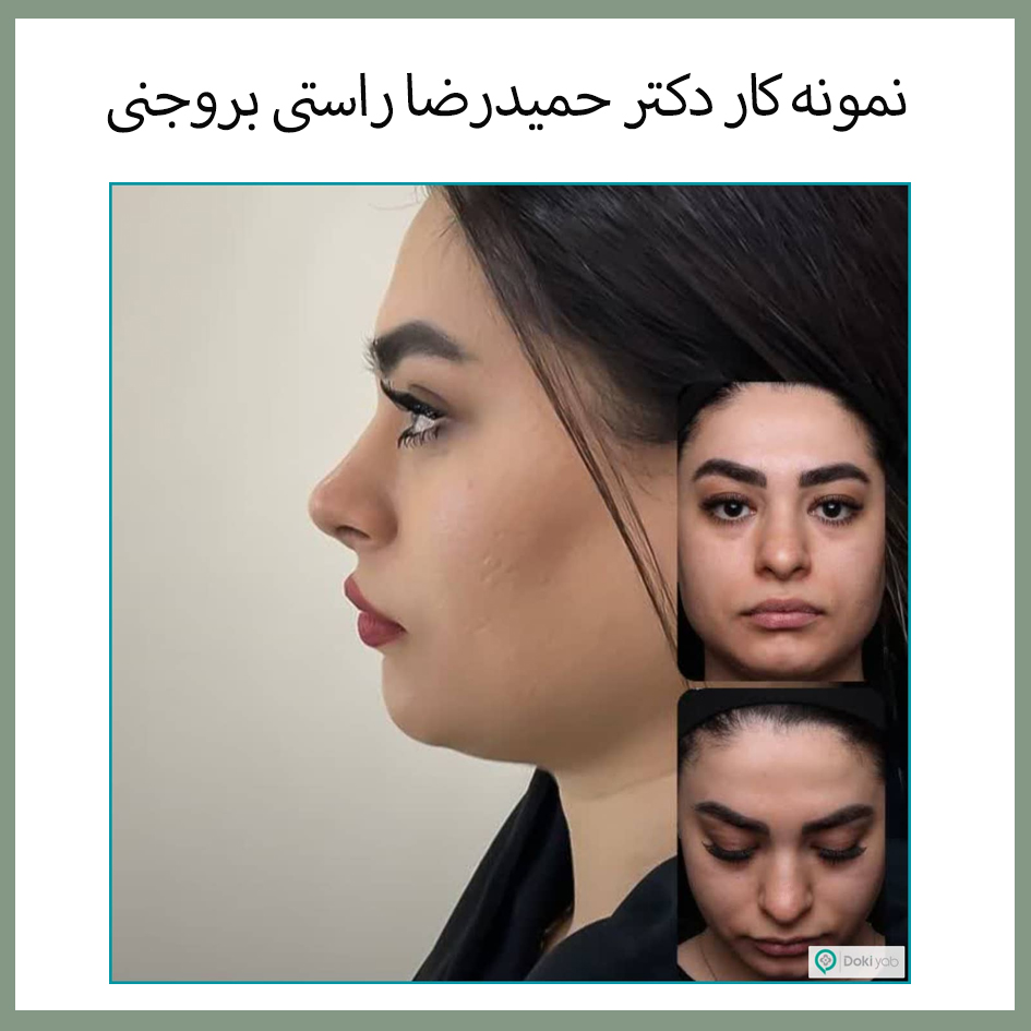 نمونه کار دکتر حمیدرضا راستی بروجنی