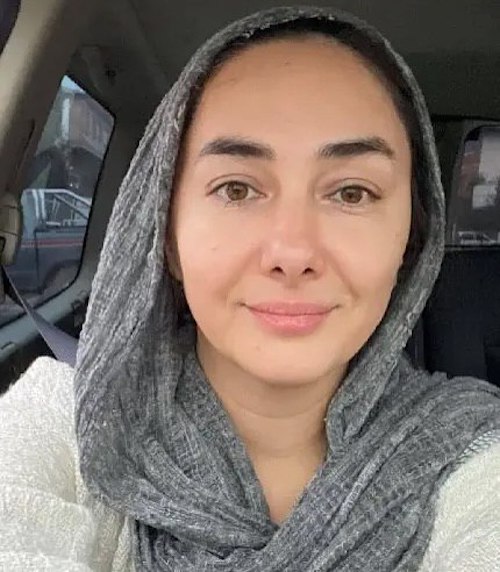 بازگشت به طبیعتِ چهره و زیبایی اصیل