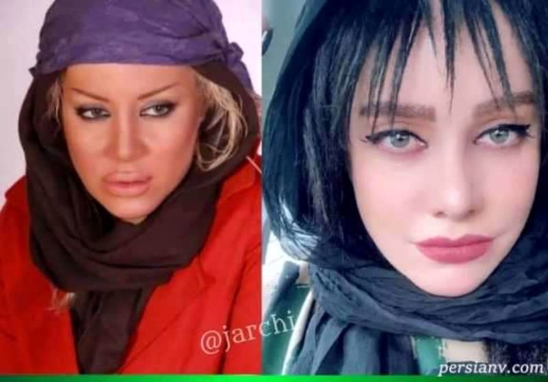 بازیگرانی که زیباتر شدند