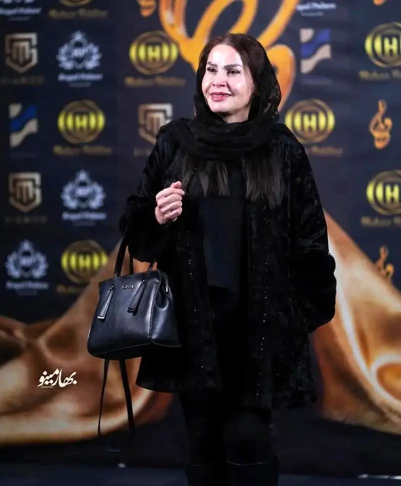 پوشش منحصر به فرد ساقی زینتی 1
