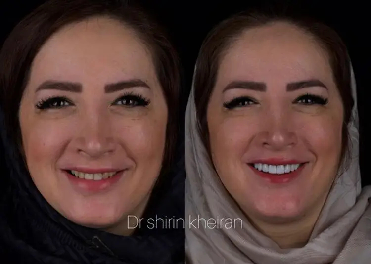 دکتر شیرین خیران – محدوده شمال تهران