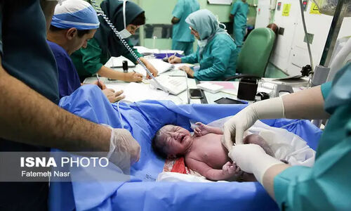 متخصص زنان هشدار داد: سزارین فقط در شرایط خاص؛ چرا زایمان طبیعی همیشه بهترین نیست؟