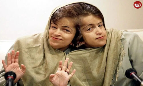 سفر شگفت‌انگیز به دهه ۵۰ با عکس‌های ناب «لاله و لادن» دوقلوهای به هم چسبیده
