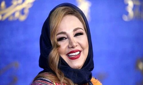 روتوش‌زدایی بهنوش بختیاری و ترلان پروانه در یک قاب؛ کدام چهره طبیعی‌تر و جذاب‌تر است؟