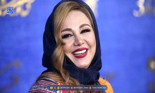 نگاهی بی‌سابقه به چهره طبیعی و جذاب بهنوش بختیاری پیش از عمل بینی!