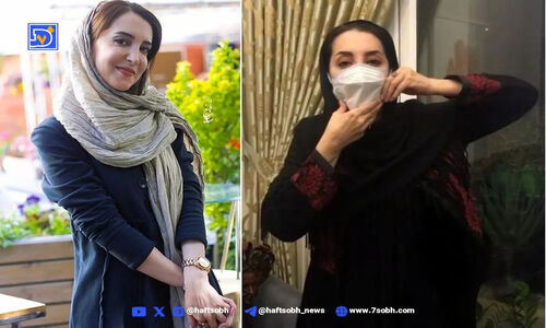 رازهای زندگی سحر جعفری جوزانی؛ از تولد در آمریکا تا علت کج‌شدگی فک‌اش چه بود؟