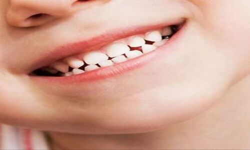 چرا دندان دائمی کودک بعد از افتادن دندان شیری دیر رویش می‌کند؟ زمان واقعی را بدانید!