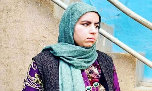 صهبا شرافتی ۲۷ ساله با تغییر چهره حیرت‌انگیز، همه را شوکه کرد!