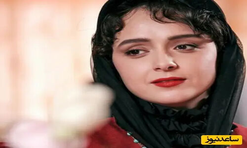 ترانه علیدوستی و بیماری دردناکی که زیبایی‌اش را به تاراج برد: پوست بدنم نابود شد!