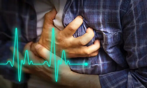 انقلاب در درمان آریتمی قلبی؛ روش نوین Pulsed Field Ablation برای اولین بار در ایران اجرا شد