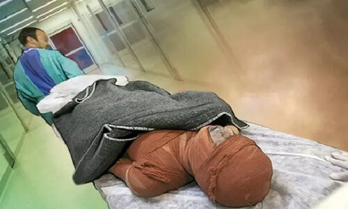 فاجعه کمبود هزار تخت سوختگی؛ بیماران در انتظار معجزه درمانی در کشور!