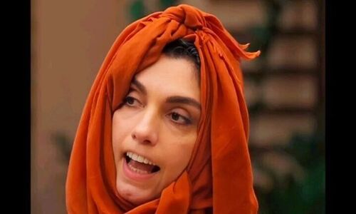 سکانس خنده دار؛ الیکا عبدالرزاقی در نقش توریست بوتاکسی در جوکر 2/ نبینی از دستت رفته