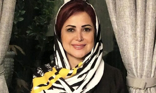 عکس/ سفر زمان؛ چهرۀ «کمند امیرسلیمانی» در 13 سالگی در اولین فیلمش؛ سال 65