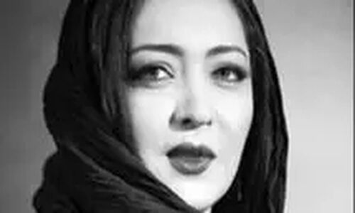 نیکی کریمی تغییر چهره داد ؛ خانم بازیگر قابل شناسایی نیست