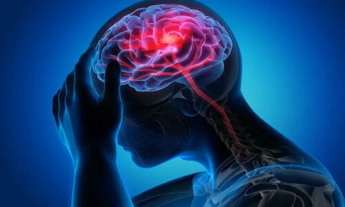 آمارهای هشداردهنده از سکته مغزی