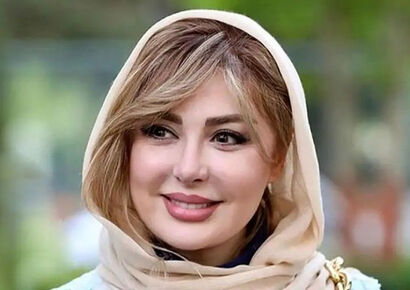 عکس | تغییر چهره نیوشا ضیغمی پس از عمل دوباره بینی
