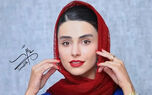 تغییرات باورنکردنی لاله مرزبان؛ وقتی عمل زیبایی هم نتونست نچرال بودنشو بگیره