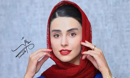 تغییرات باورنکردنی لاله مرزبان؛ وقتی عمل زیبایی هم نتونست نچرال بودنشو بگیره